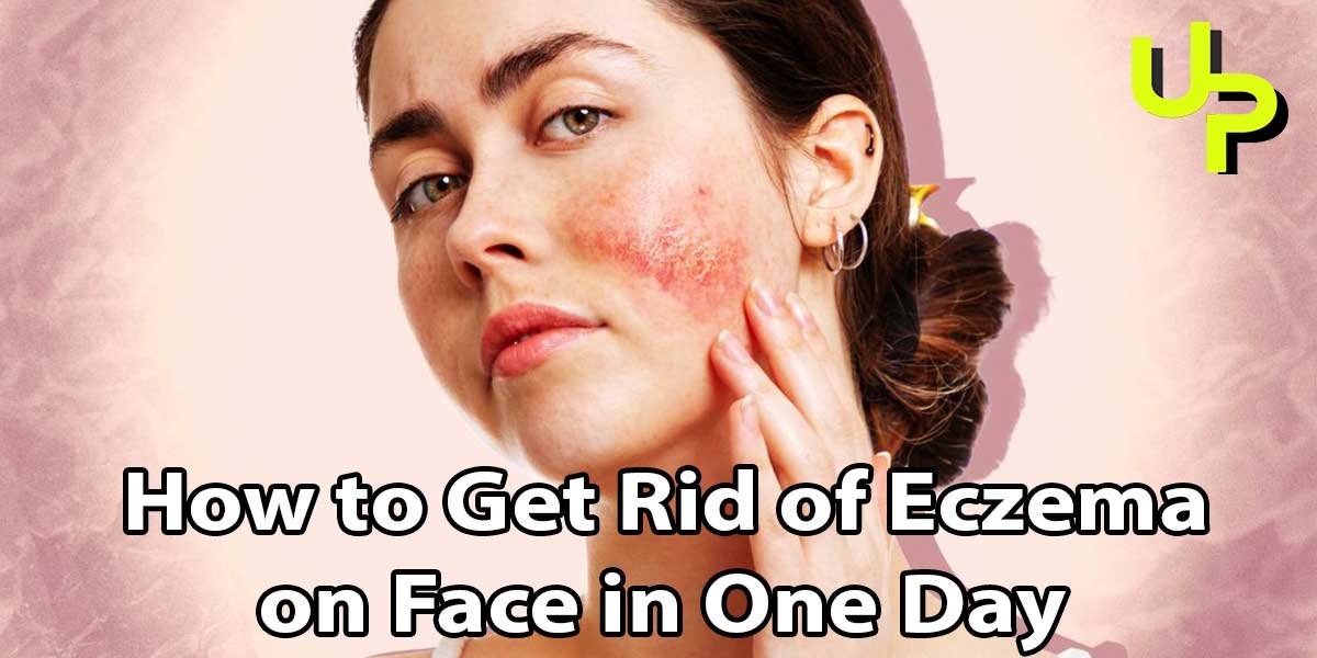 How to Get Rid of Eczema on Face in One Day